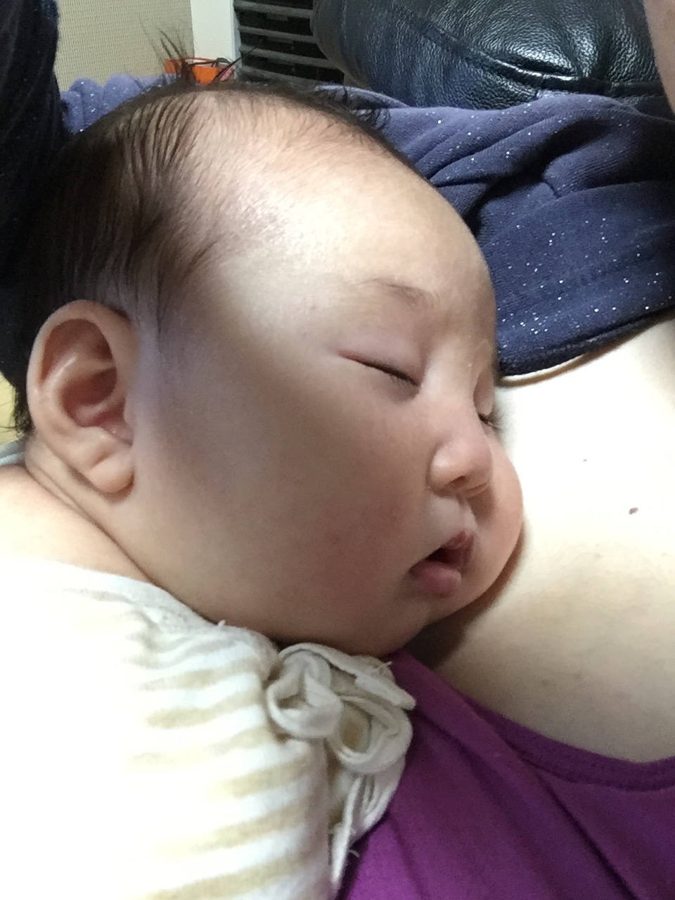 乳児 湿疹 ヒルドイド ヒルドイドソフト軟膏の副作用と正しい使い方 赤ちゃんは大丈夫